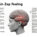 brain zap feeling